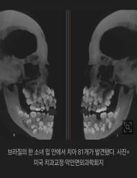보기만해도 아파지는듯한